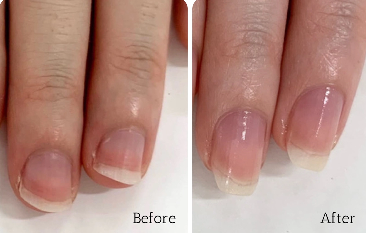 自由が丘ネイルケア専門店｜深爪・噛み爪・むしり爪・丸爪・小爪なら最強の地爪育成サロン｜ROSE ROSE｜寺木智子