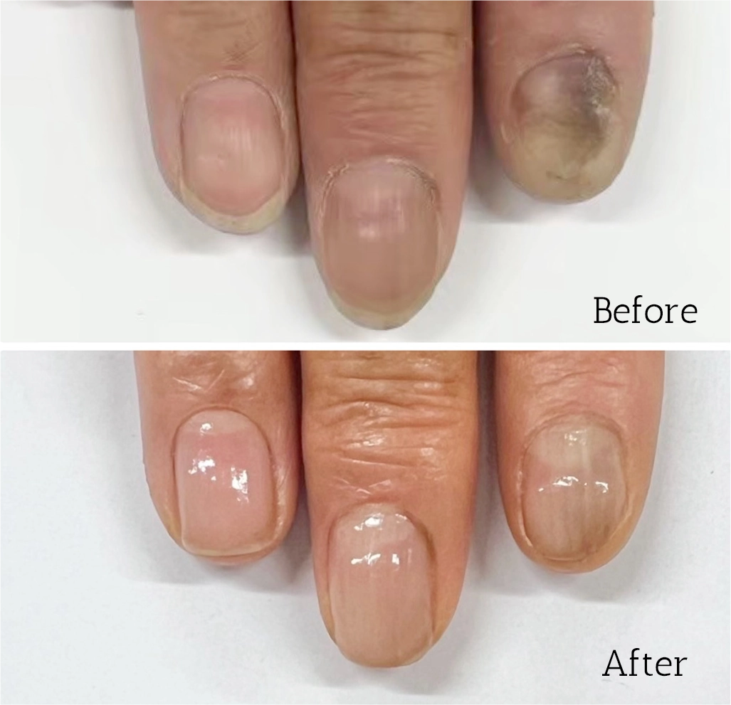 自由が丘ネイルケア専門店｜深爪・噛み爪・むしり爪・丸爪・小爪なら最強の地爪育成サロン｜ROSE ROSE｜寺木智子