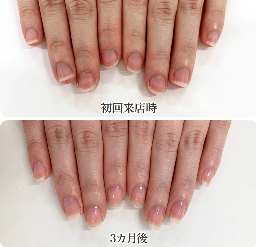 自由が丘ネイルケア専門店｜ROSE ROSEの口コミ