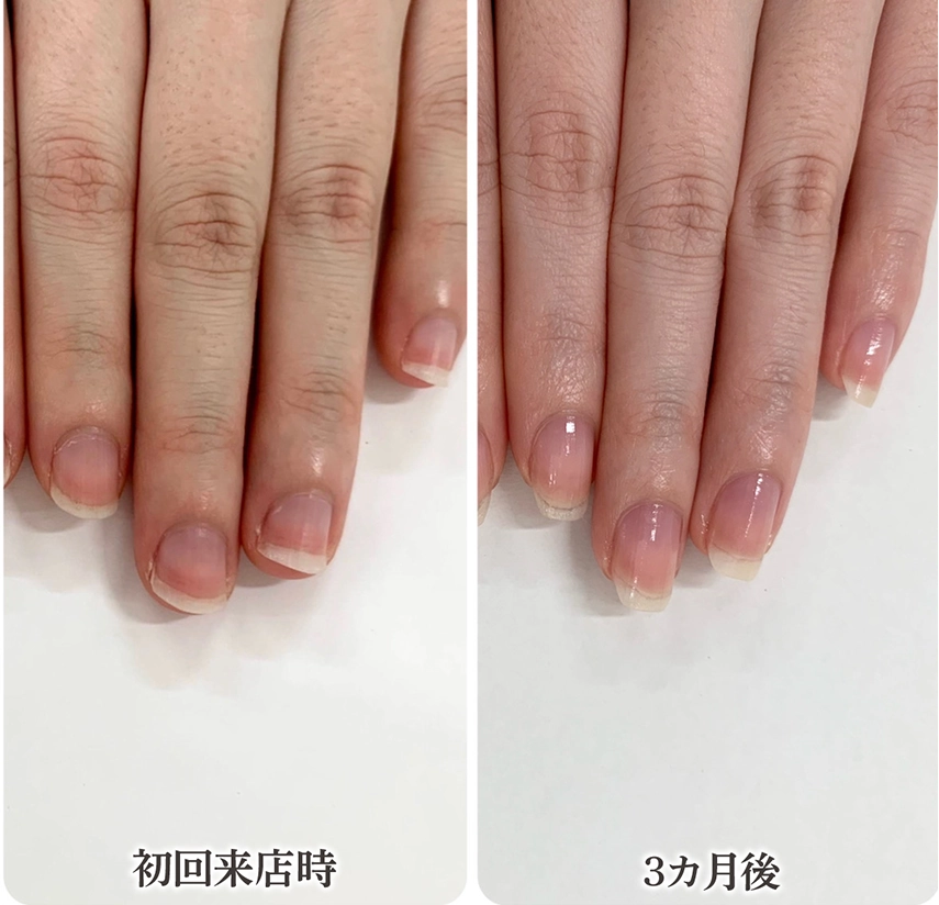 自由が丘ネイルケア専門店｜ROSE ROSEの口コミ