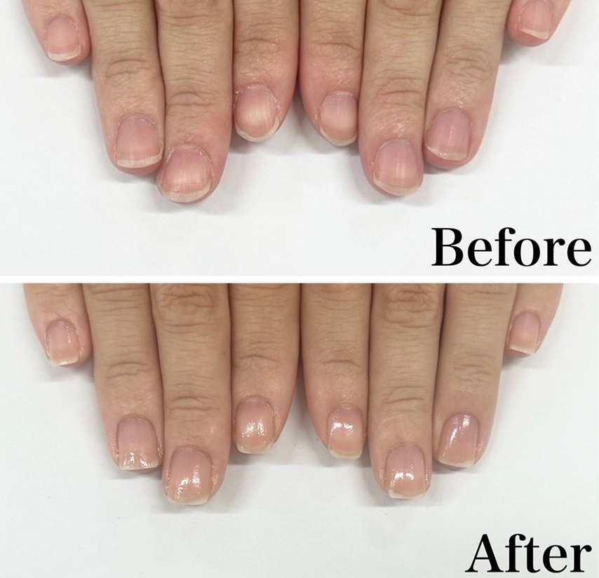 自由が丘ネイルケア専門店｜ROSE ROSEの口コミ