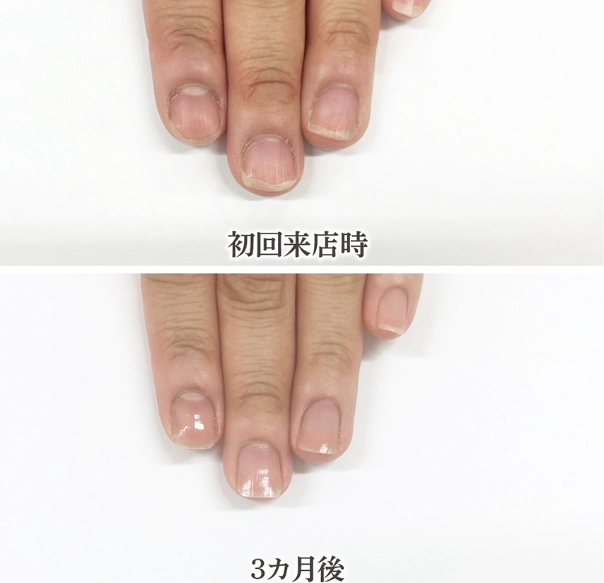 自由が丘ネイルケア専門店｜ROSE ROSEの口コミ