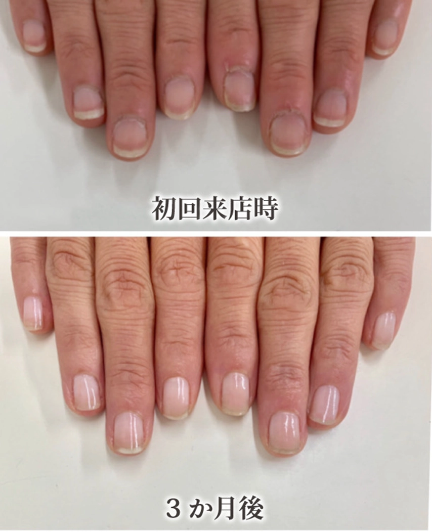 自由が丘ネイルケア専門店｜ROSE ROSEの口コミ