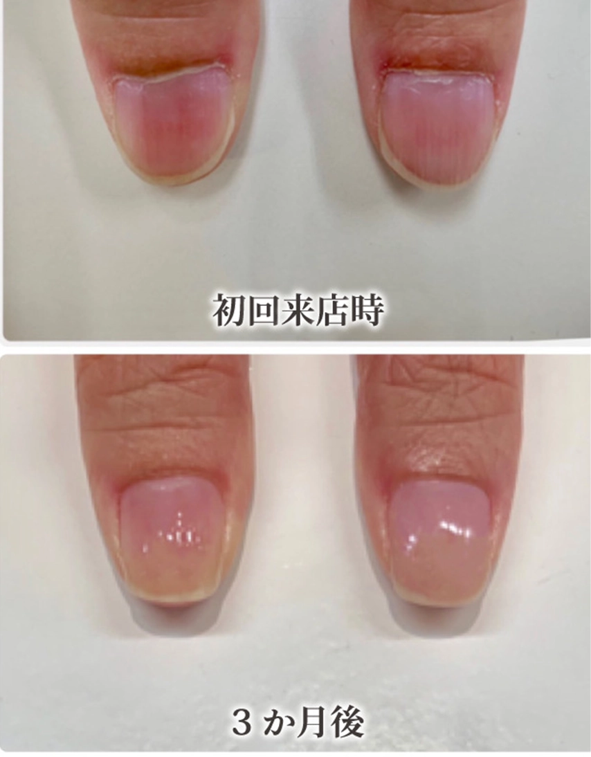 自由が丘ネイルケア専門店｜ROSE ROSEの口コミ