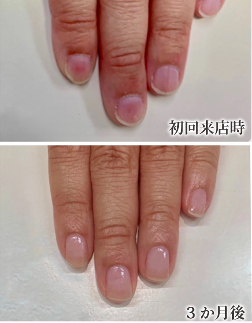 自由が丘ネイルケア専門店｜ROSE ROSEの口コミ