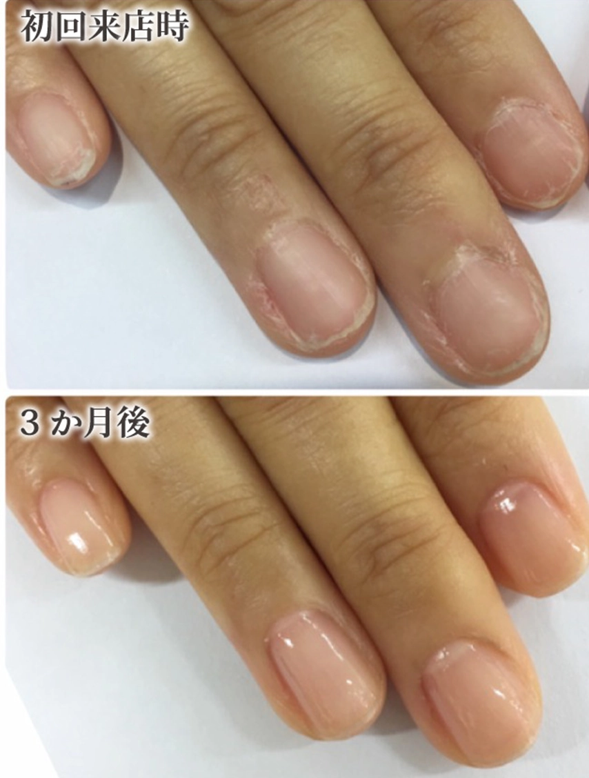 自由が丘ネイルケア専門店｜ROSE ROSEの口コミ