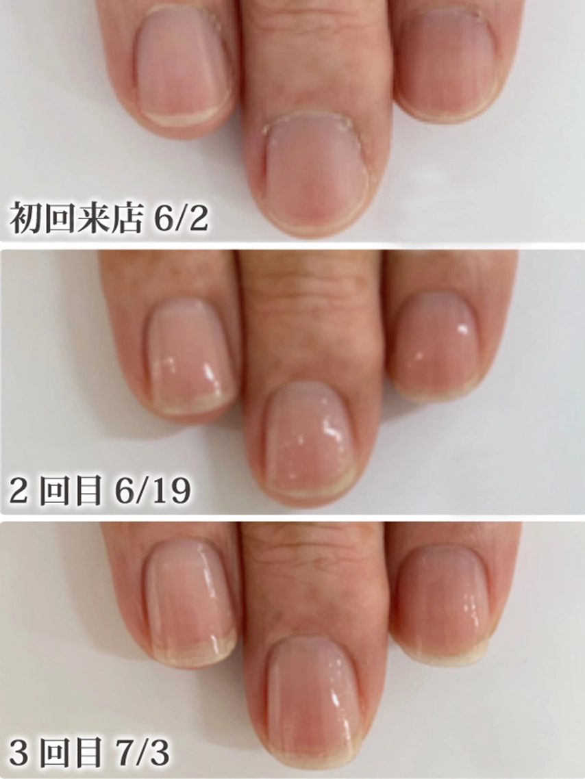 自由が丘ネイルケア専門店｜ROSE ROSEの口コミ