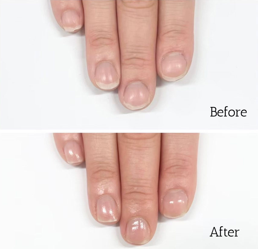 自由が丘ネイルケア専門店｜ROSE ROSEの口コミ