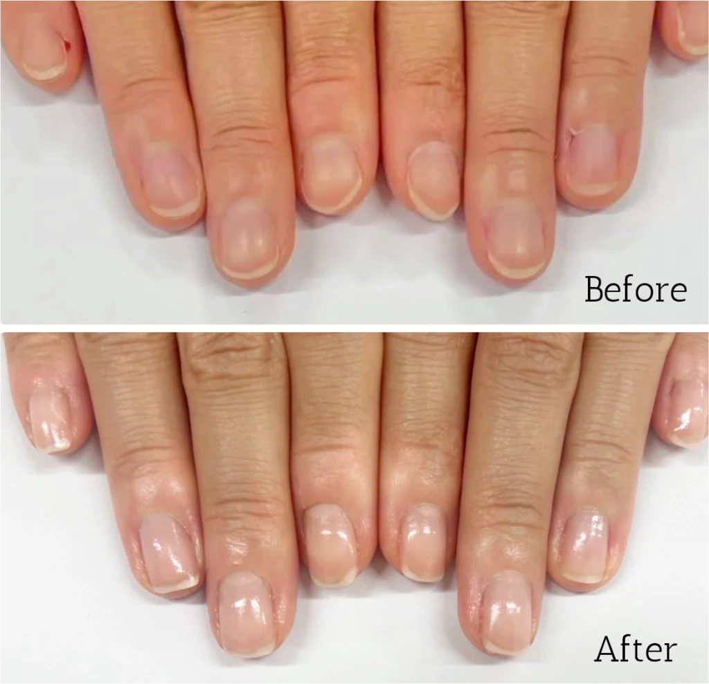 自由が丘ネイルケア専門店｜ROSE ROSEの口コミ