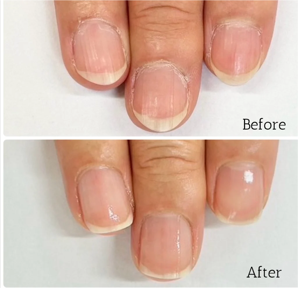 自由が丘ネイルケア専門店｜ROSE ROSEの口コミ