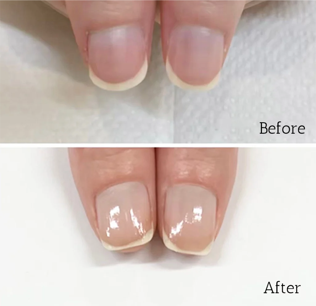 自由が丘ネイルケア専門店｜ROSE ROSEの口コミ