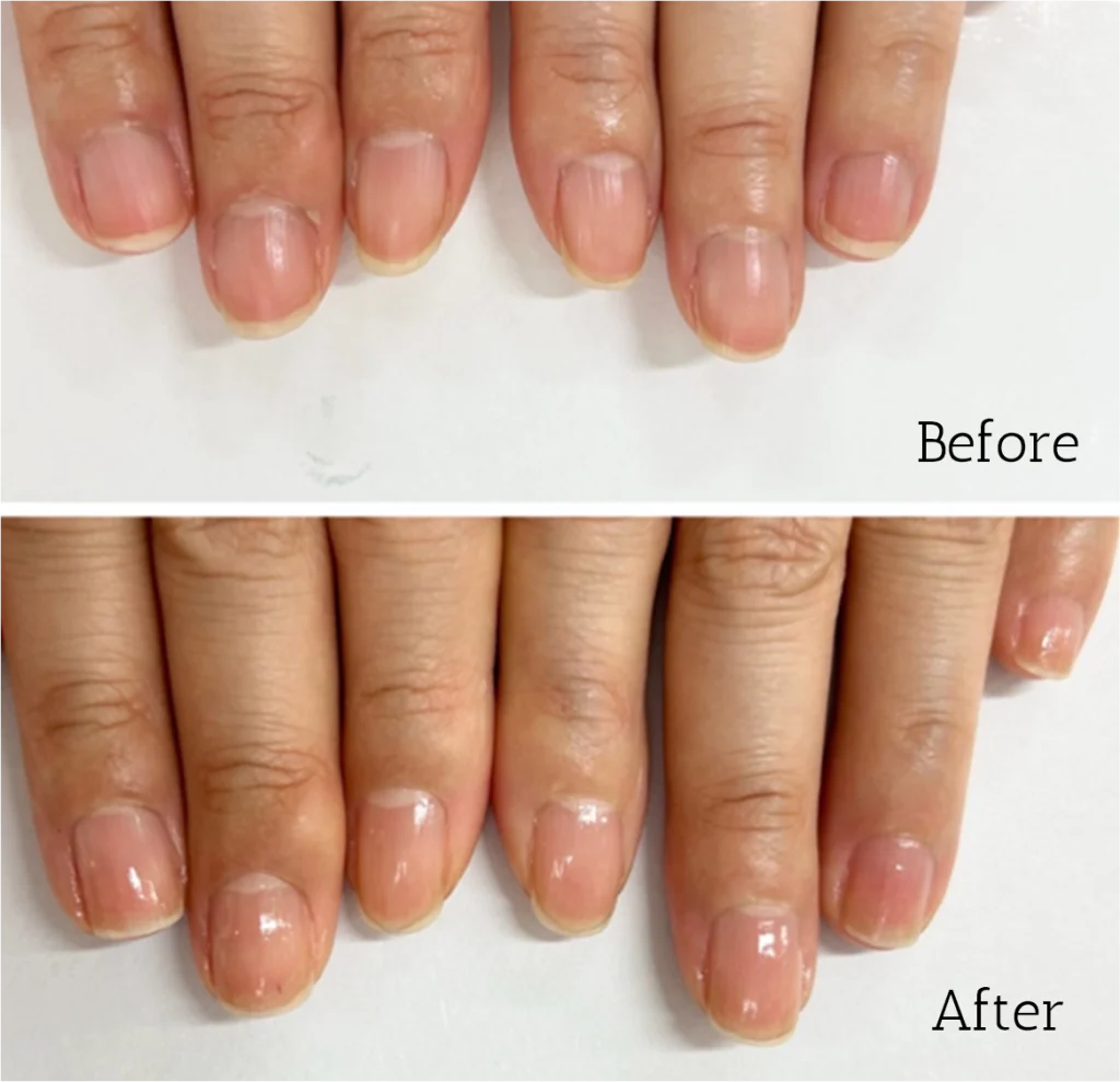 自由が丘ネイルケア専門店｜ROSE ROSEの口コミ