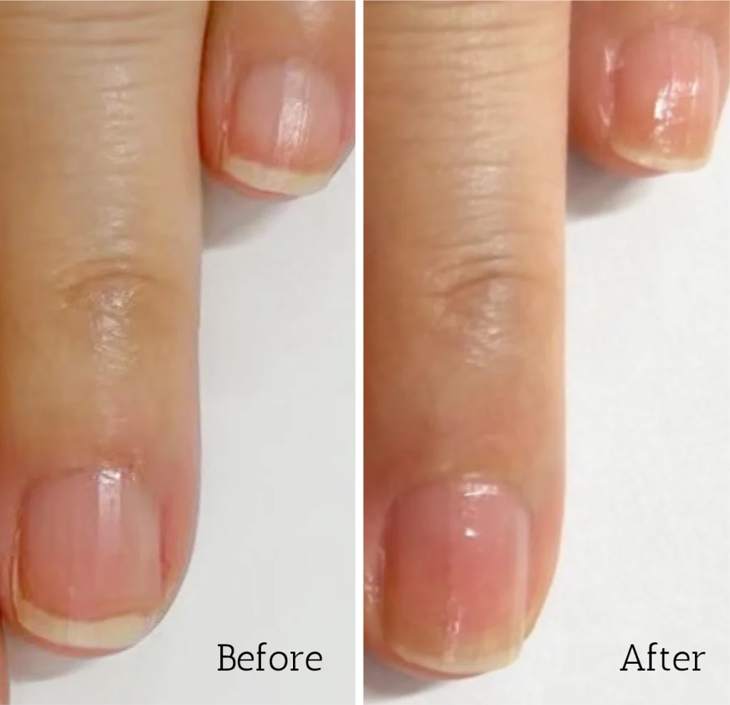 自由が丘ネイルケア専門店｜ROSE ROSEの口コミ