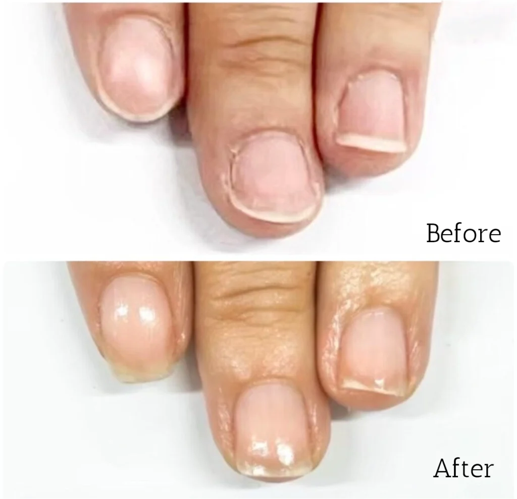 自由が丘ネイルケア専門店｜ROSE ROSEの口コミ