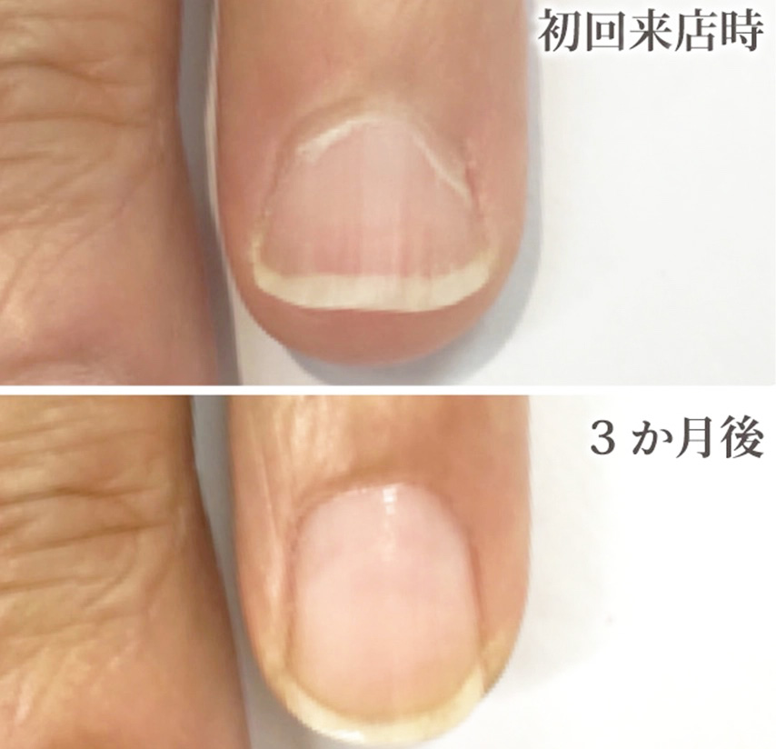 自由が丘ネイルケア専門店｜ROSE ROSEの口コミ