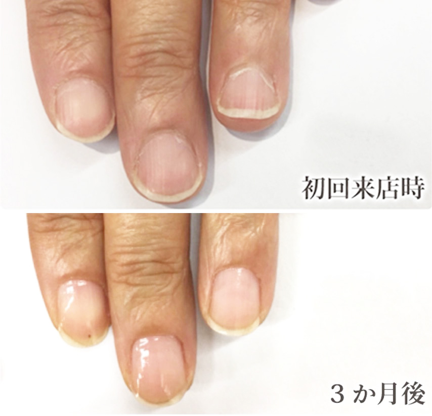 自由が丘ネイルケア専門店｜ROSE ROSEの口コミ