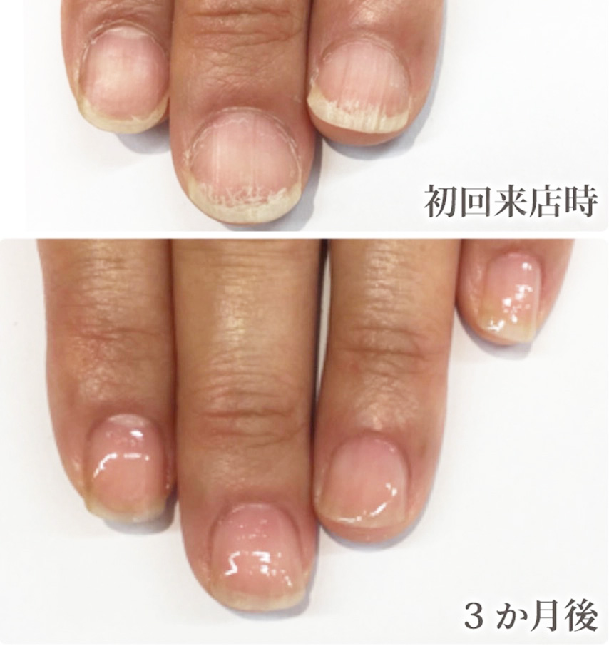 自由が丘ネイルケア専門店｜ROSE ROSEの口コミ