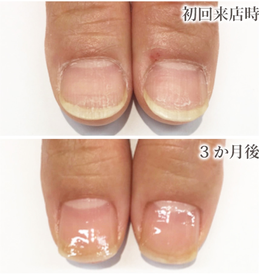 自由が丘ネイルケア専門店｜ROSE ROSEの口コミ