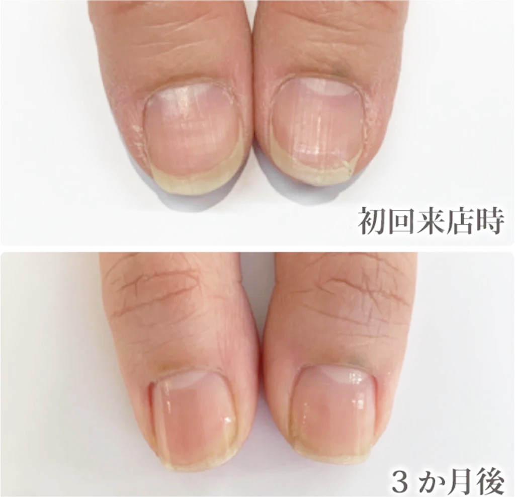 自由が丘ネイルケア専門店｜ROSE ROSEの口コミ