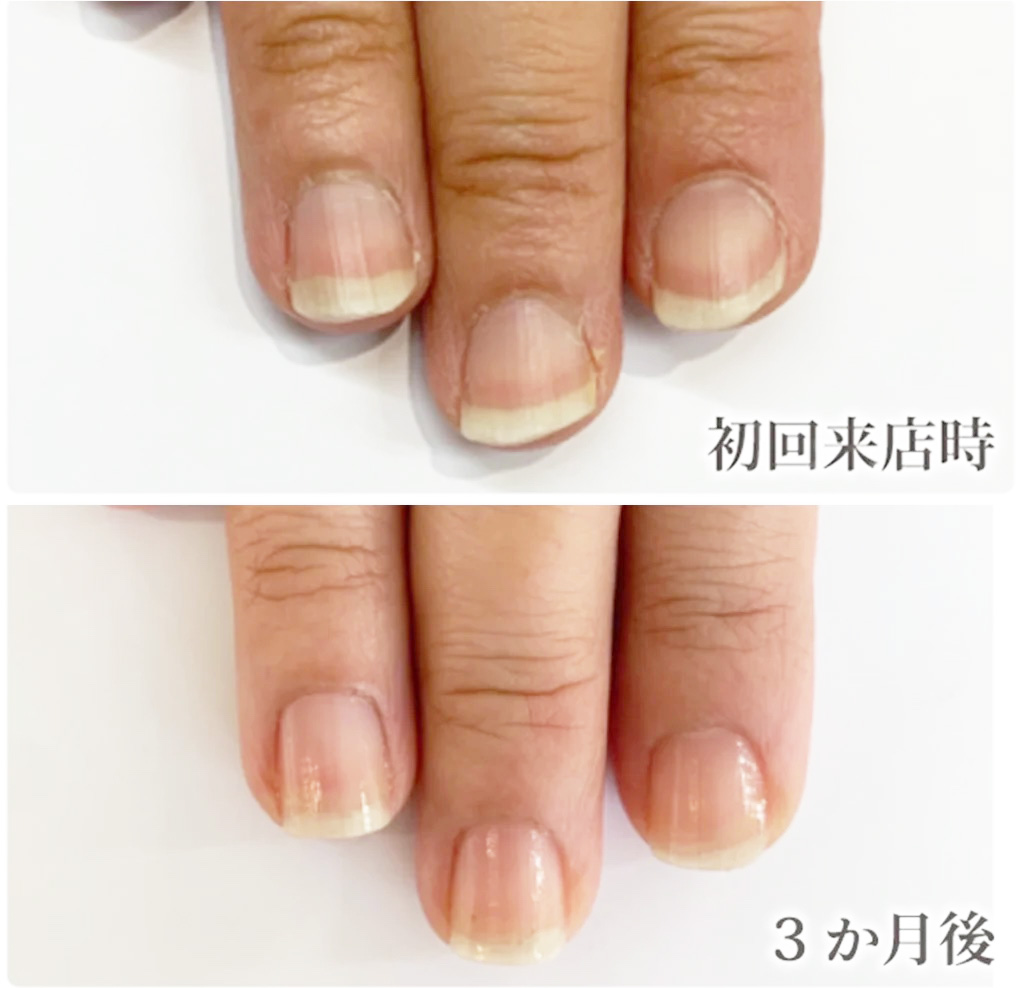 自由が丘ネイルケア専門店｜ROSE ROSEの口コミ