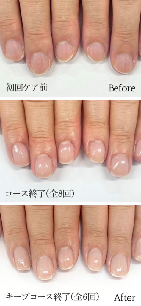 自由が丘ネイルケア専門店｜ROSE ROSEの口コミ