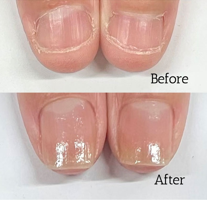 東京自由が丘ネイルサロン｜最強のネイルケア専門店ROSE ROSE｜深爪対応