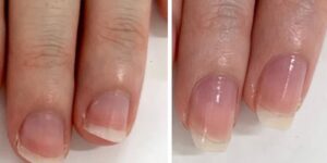 東京自由が丘ネイルサロン｜最強のネイルケア専門店ROSE ROSE｜深爪対応